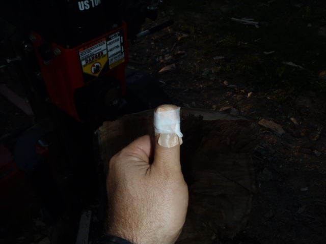 I protected the heavy steel splitting wedge from unslightly scratches by keeping my thumb between it and a wildly unbalanced block of wood. Note: if you roll a 140 pound block of wood into an area 1" too short you will learn a valuable lesson. Yes, I carry a first aid kit. Also, if you damage a finger on a 27 ton ram and it happens when the engine is off, that's about the best case scenario. (Also, I was wearing heavy leather gloves too. I hate to think what would have happened without them. My hitchiking career would be over!!) 